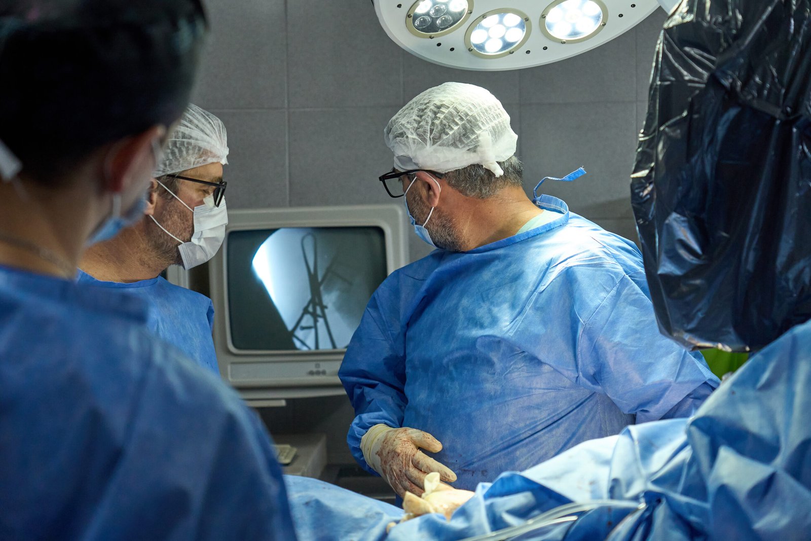 Stapler surgery for piles