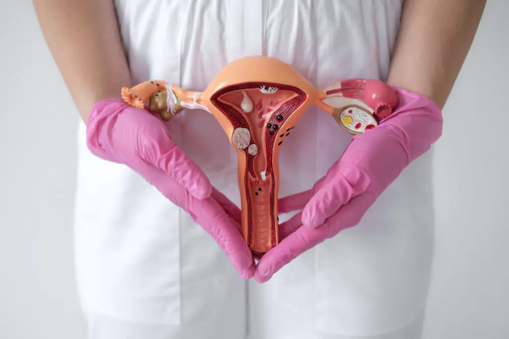 Fibroid
